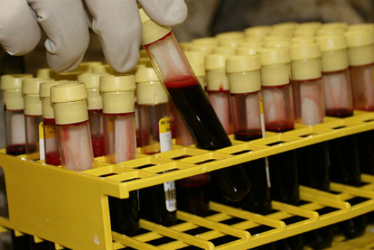 What Blood Shows Scientists About Suicide Risk