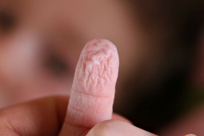 New Hope For Regrowing Severed Limbs, Just Like Lizards’ Tails