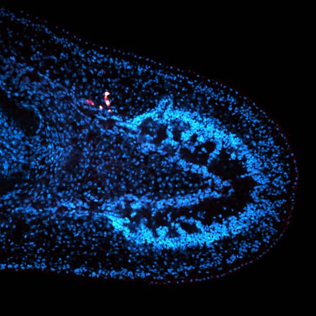 Worm Regenerates a Whole New Body From a Single Cell