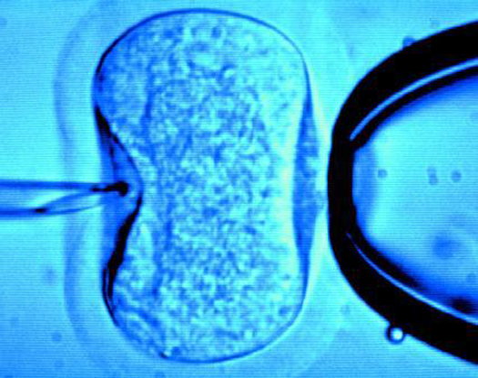 Technique For Making Three-Parent Babies Is Safe, Study Finds