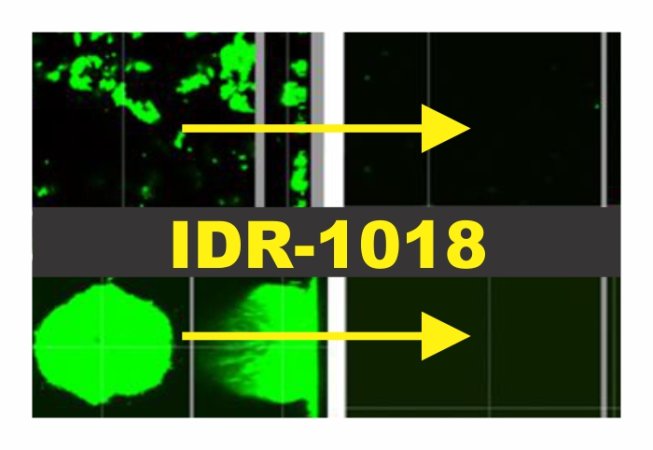 A New Peptide Tackles Infections, Biofilms, & Antibiotic Resistance