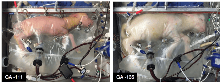 This ‘artificial womb’ is like science fiction—but uteruses aren’t out of a job yet