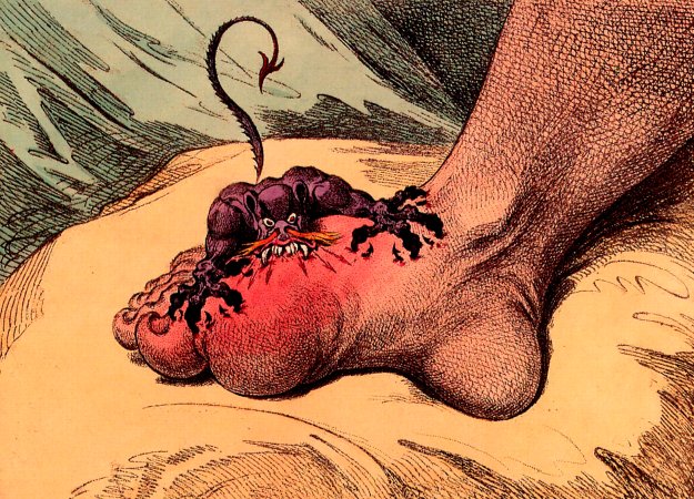 6 of the most important drug milestones of all time