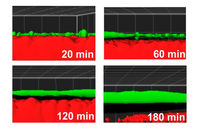 The Case of Sepsis And The Swarming Staph