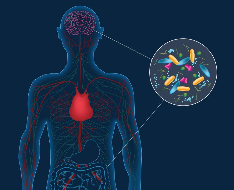 Gut microbes may play a role in Parkinson’s disease