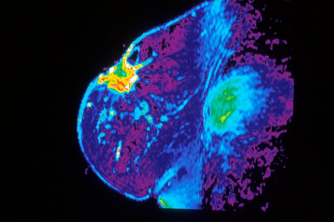 The Confounding Commandments Of Cancer Screening
