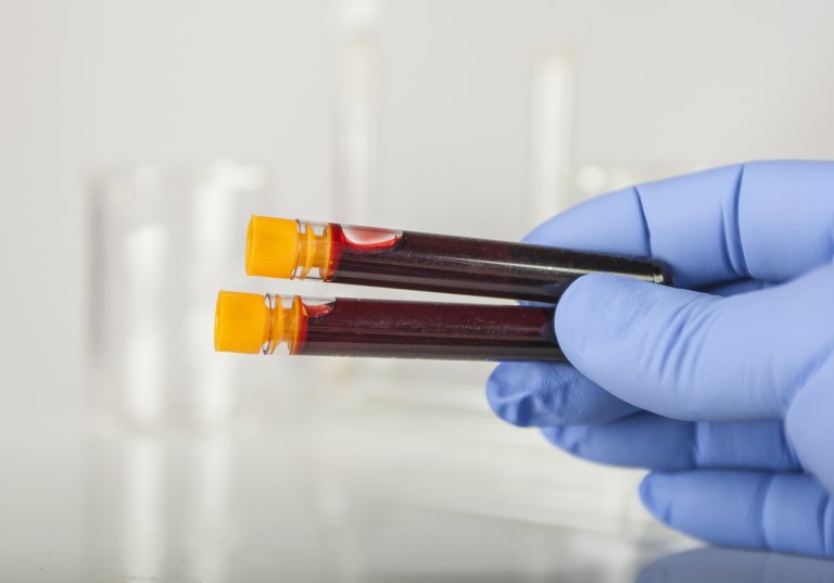a hand wearing blue gloves holds two vials of blood