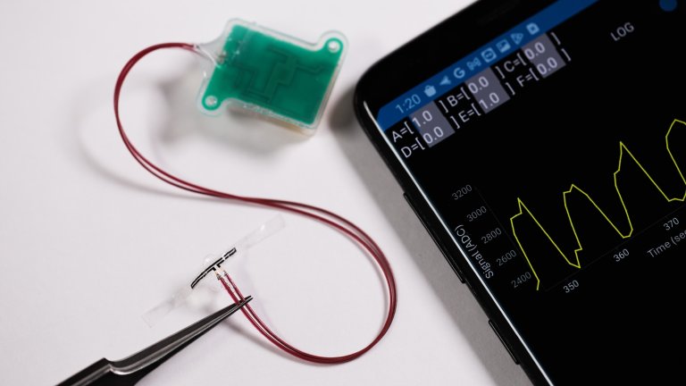 Bladder sensor next to smartphone displaying its app